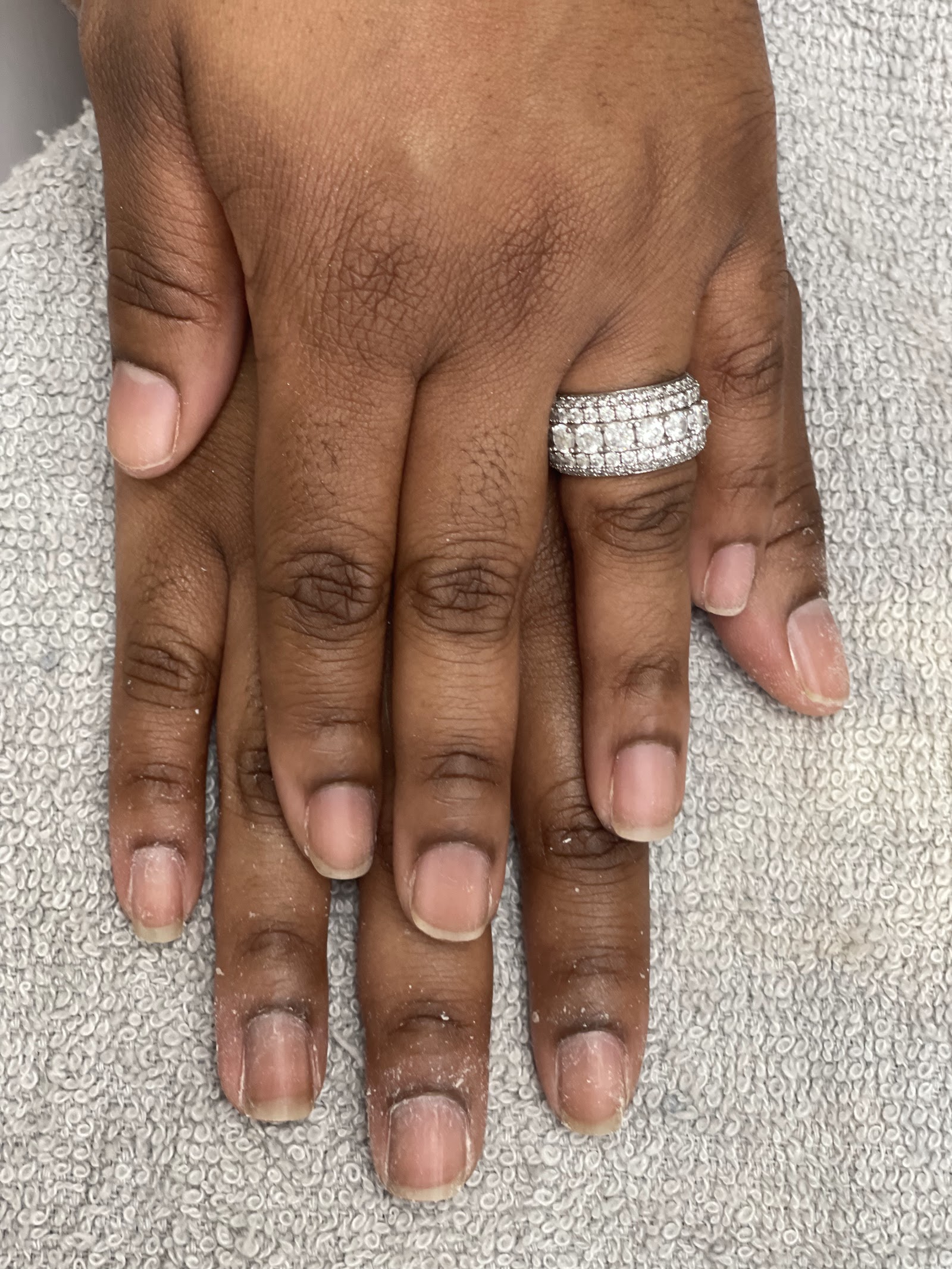 Palmetto Nail and Foot Care nail photo 1