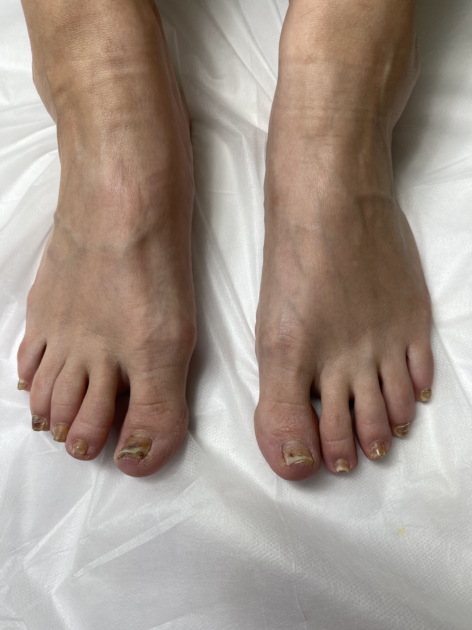 Palmetto Nail and Foot Care nail photo 2